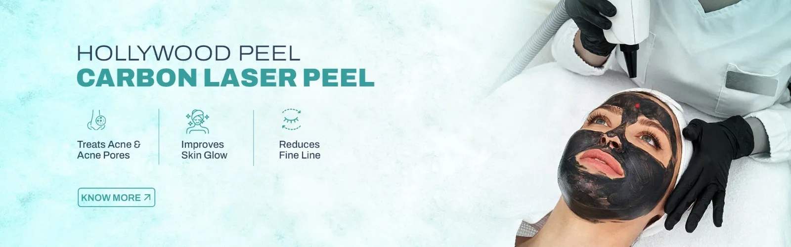 Carbon Laser Peel DV - Banner (NP)