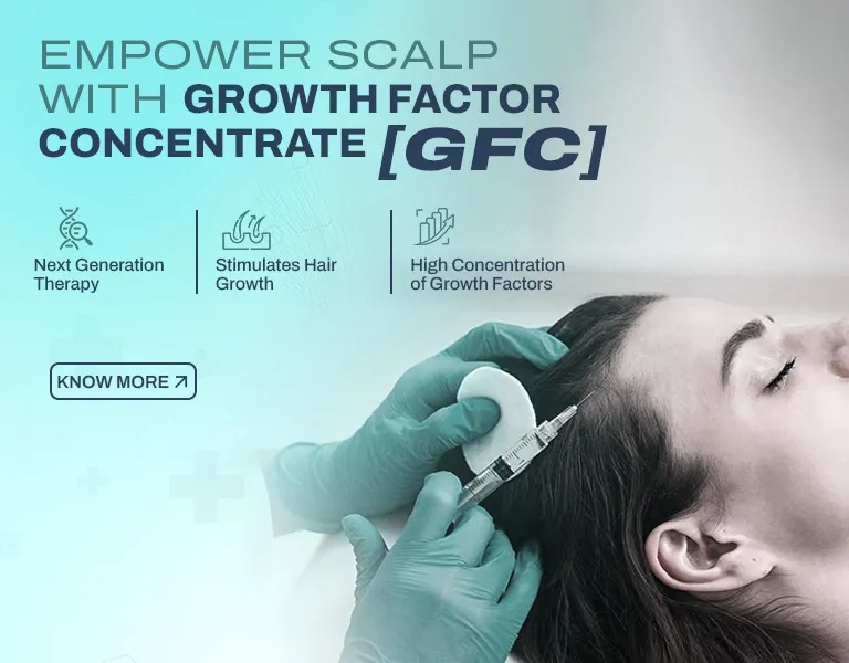 GFC MV - Banner (NP)