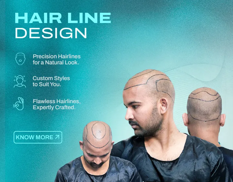 Hair Line_Design_MV - Banner (NP)