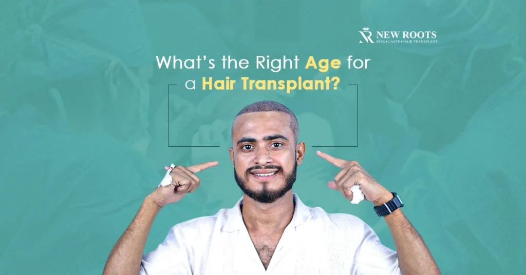 Perfect age for hair transplant