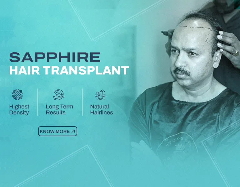 Sapphire HT MV - Banner (NP)