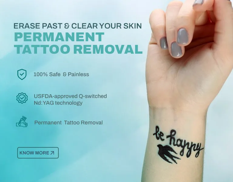 Tattoo Removal MV - Banner (NP)