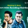 Actors with Receding Hairlines