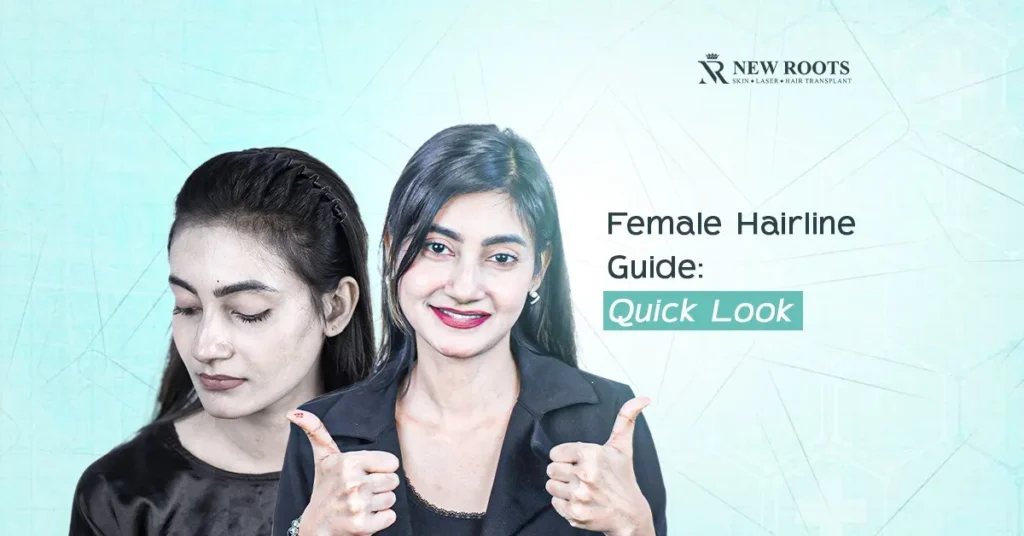 Female Hairline Types