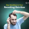 How to cure a receding hairline