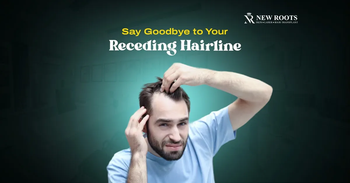 How to cure a receding hairline