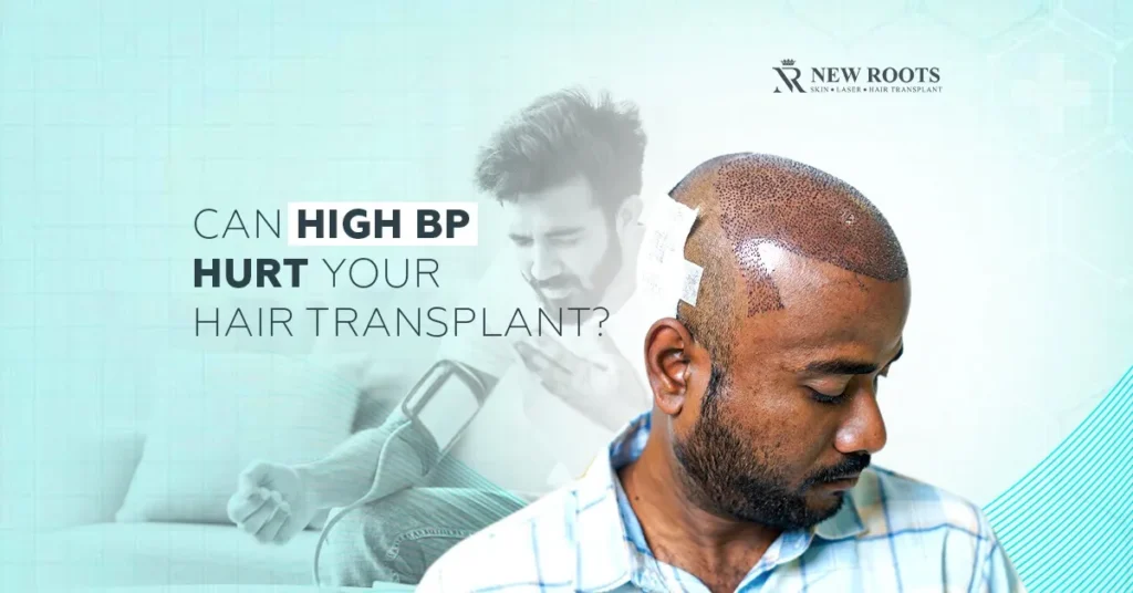 Hypertension Impact Hair Transplant
