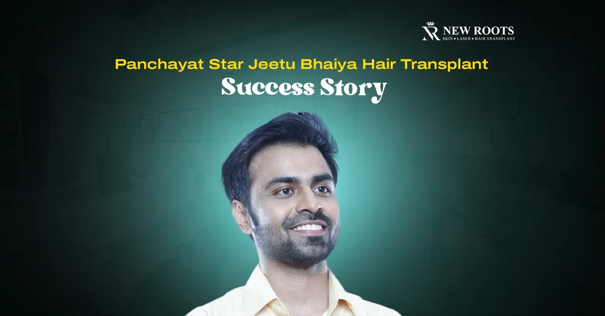 Jitendra Kumar Hair Transplant