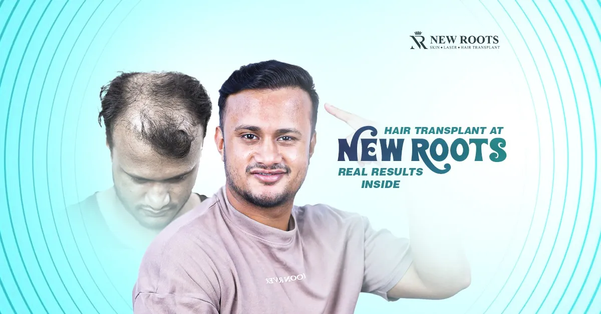 New Roots Hair Transplant Clinic