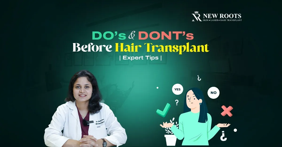 dos and Don'ts Before the Hair Transplant