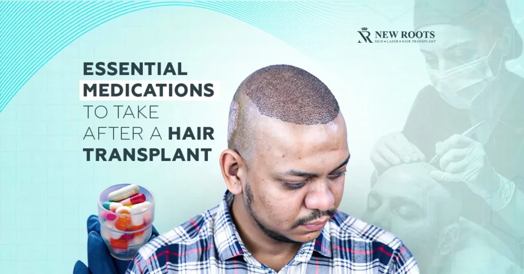 Medication duration varies, but generally, antibiotics for 3-5 days, pain relievers within 1 week, hair regrowth medications for 3-6 months, or as recommended, depending on the type of hair transplant surgery.