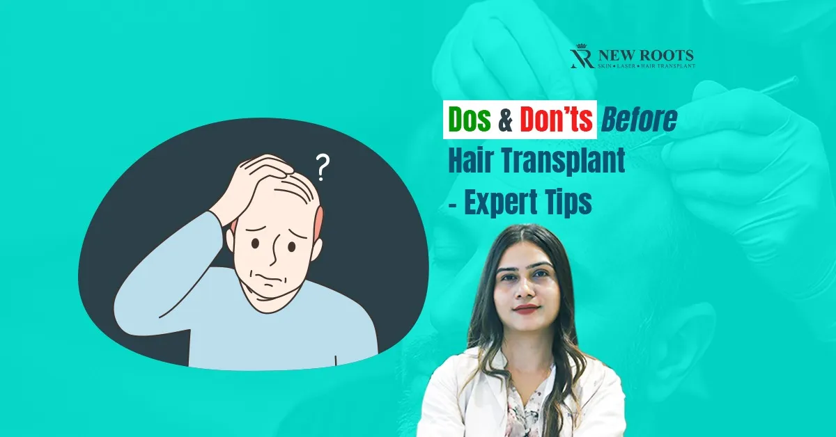 DOs & DON’Ts Before Hair Transplant