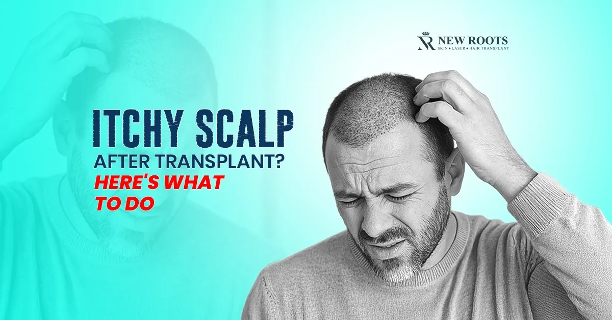 Dealing with Itching and Redness Post-Transplant