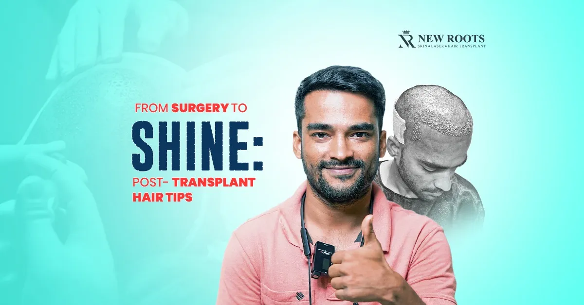 Hair Care Post-Transplant
