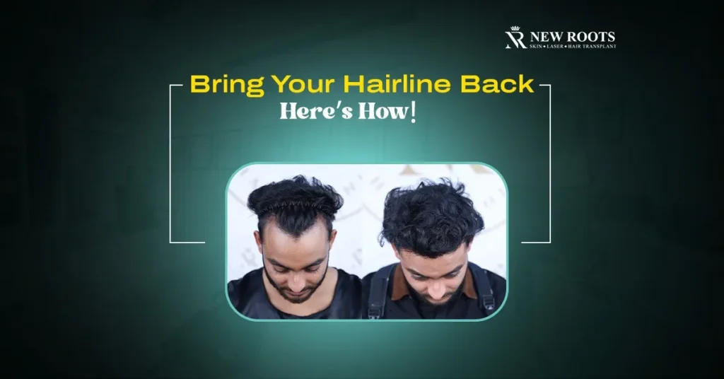 How to Get Hairline Back