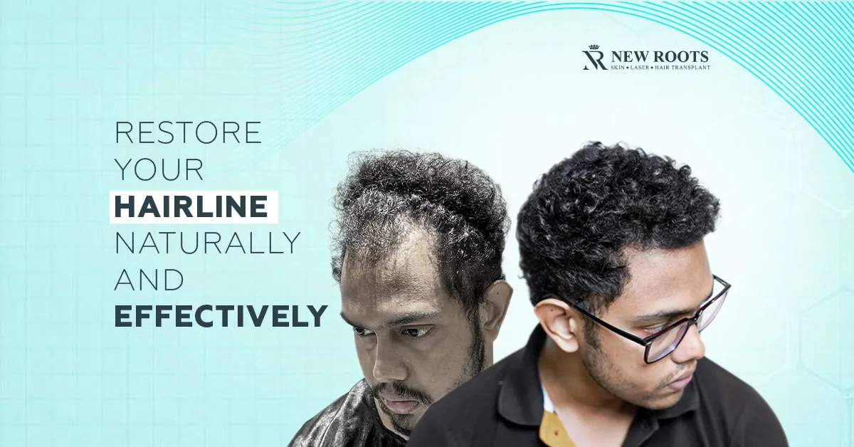 How to Treat Receding Hairline