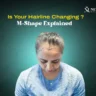 M-Shaped Hairline in Female
