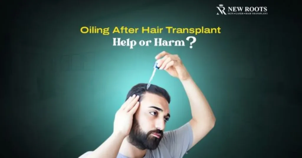 Oil After Hair Transplant