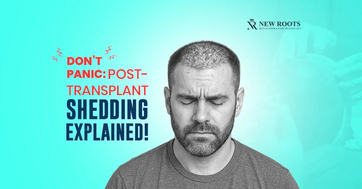 Post-Transplant Shedding