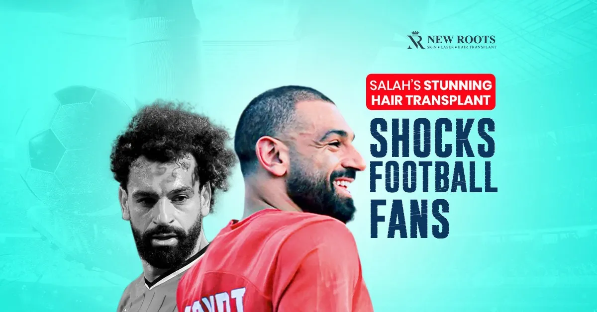 Salah hair transplant