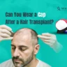 cap after hair transplant surgery