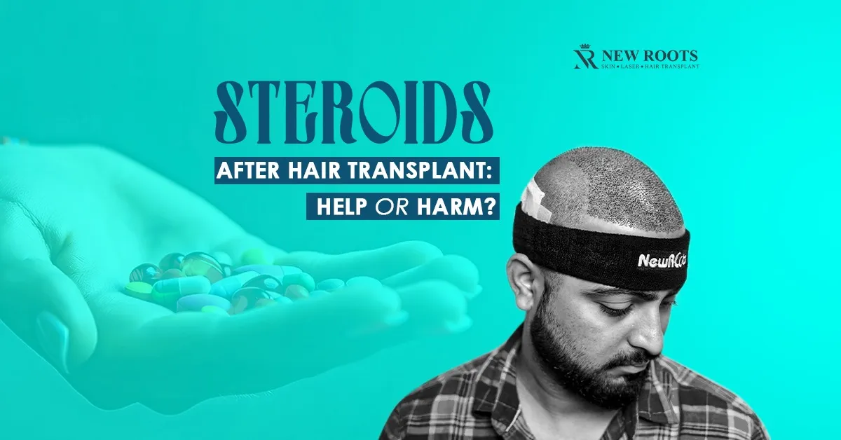 steroids after hair transplant