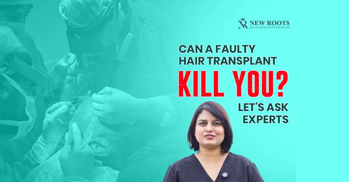 Botched Hair Transplant
