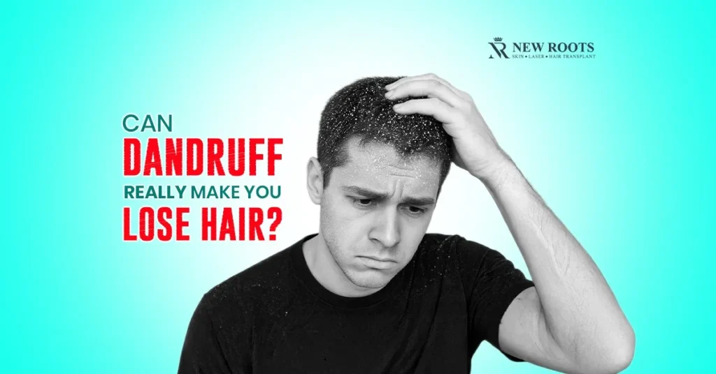 Can dandruff cause hair loss