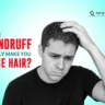 Can dandruff cause hair loss