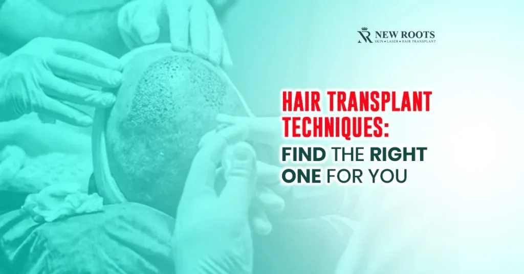 Hair Transplant Techniques