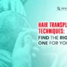 Hair Transplant Techniques