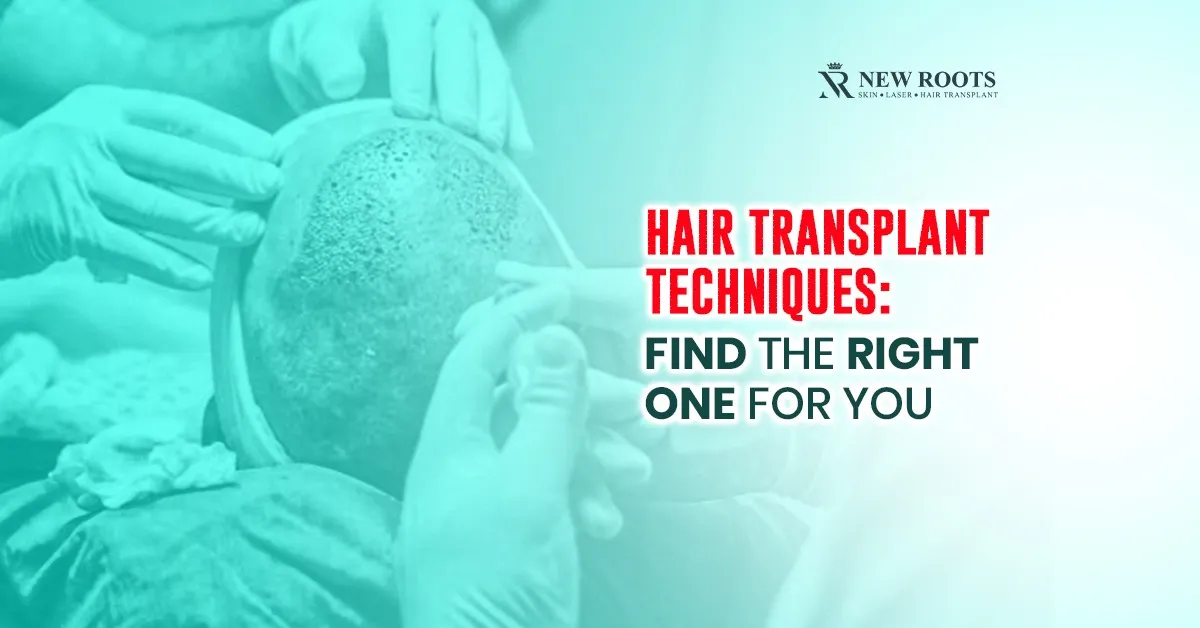 Hair Transplant Techniques