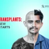 Hair Transplants