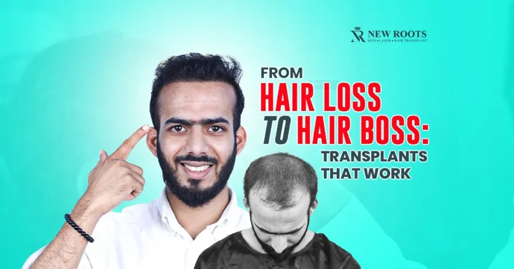 Hair Transplants and Treatment