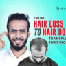 Hair Transplants and Treatment