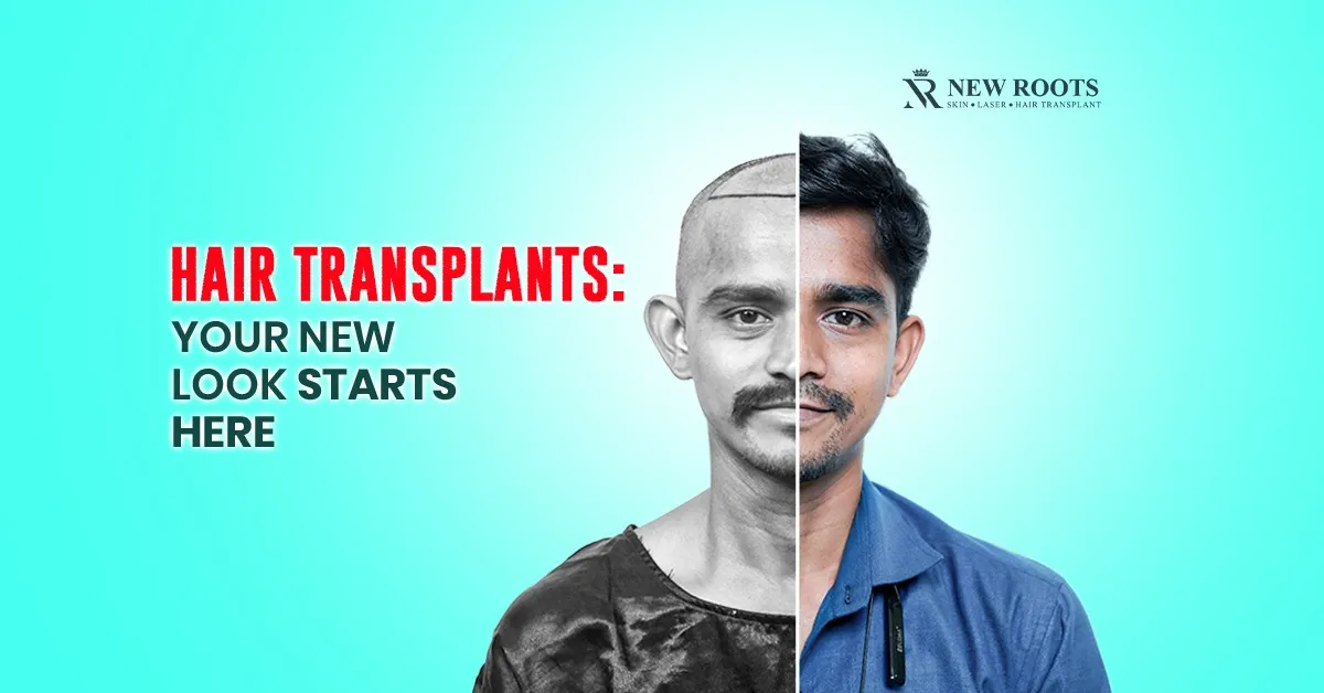 Hair Transplants