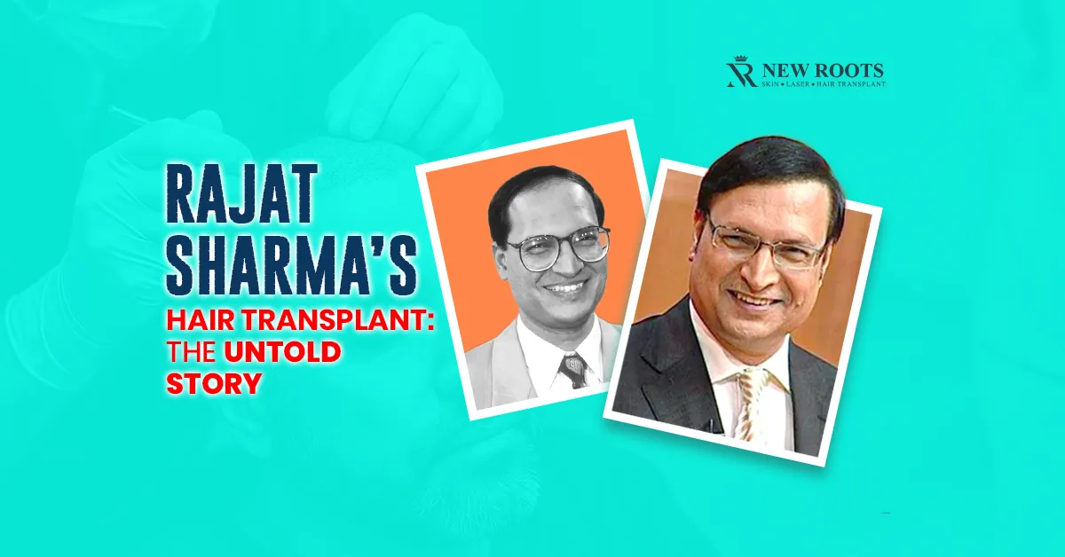 Rajat Sharma Hair Transplant
