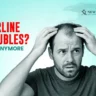 Receding Hairline Issues