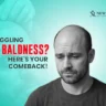 Struggling with Baldness