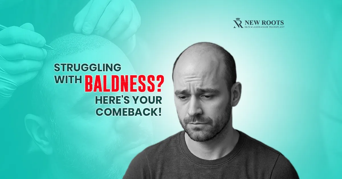 Struggling with Baldness