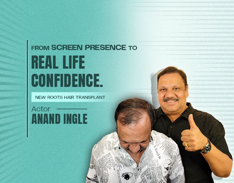 Actor - ANAND INGLE - MV Banner