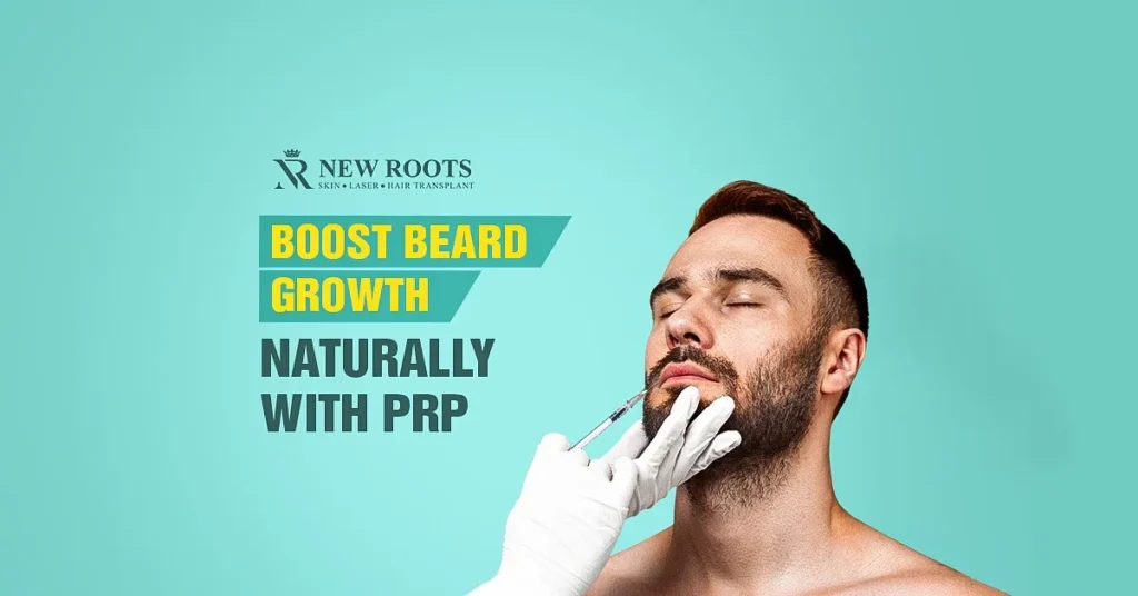 PRP for Beard Growth
