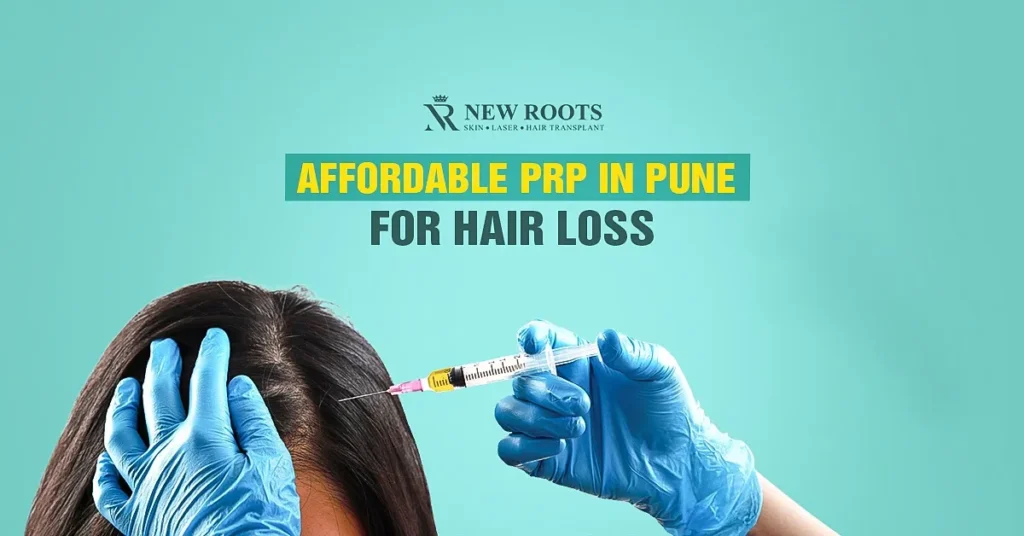 PRP hair treatment cost in Pune