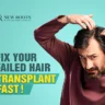 Failed Hair Transplant Corrected