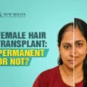 Is a Female Hair Transplant Permanent