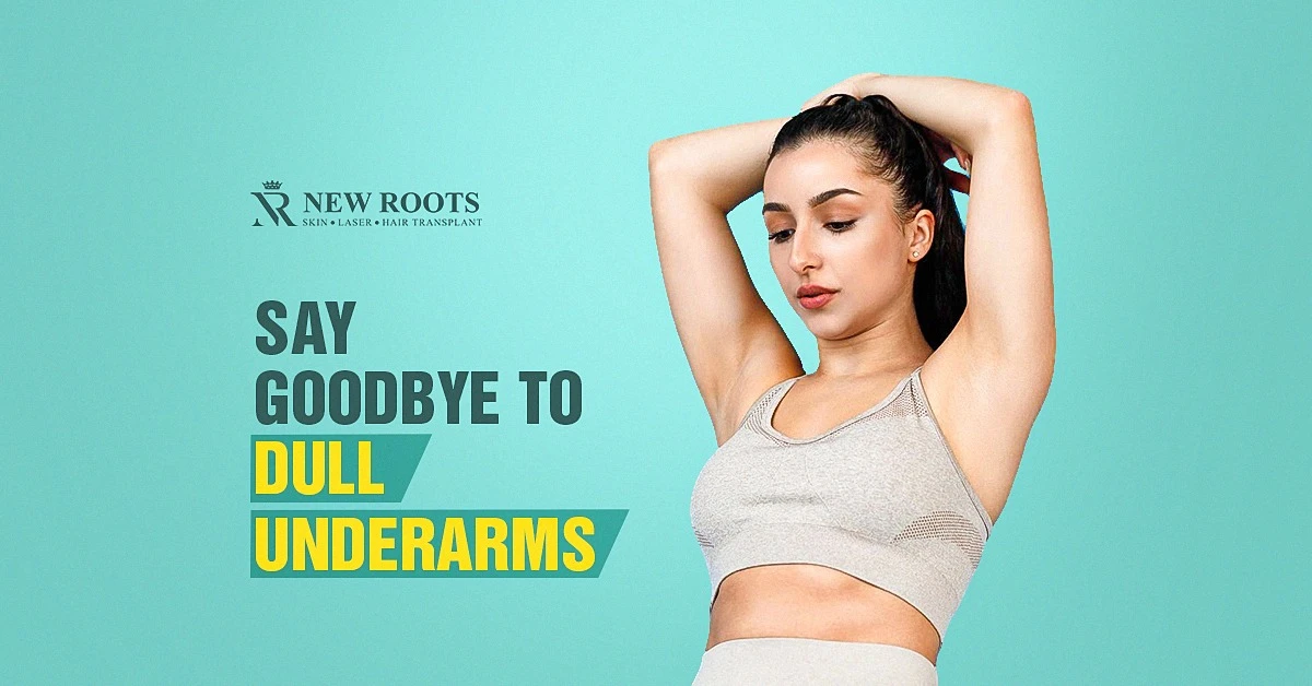 dark underarms, sweat friction