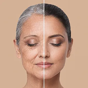 Anti Aging