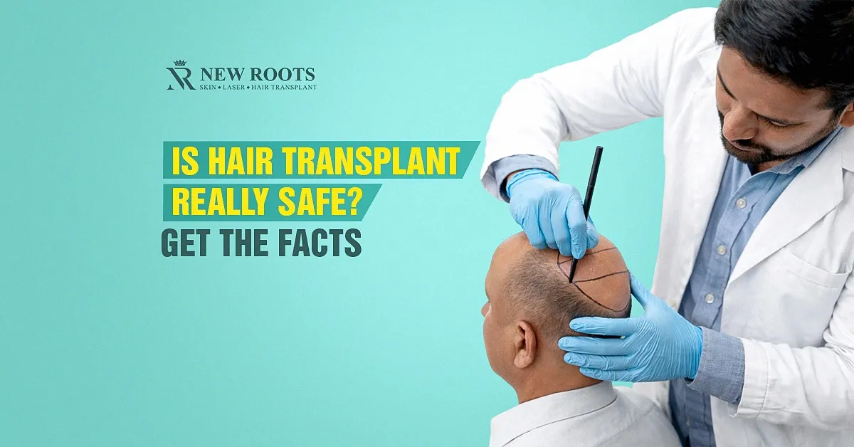 Is hair transplant safe