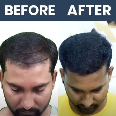 SLIT Result 03 - Mar 2025