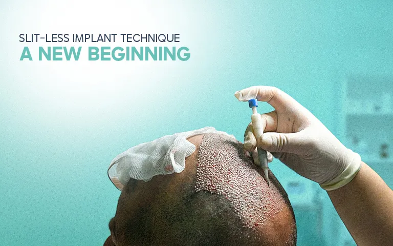 Slit-less Implant Technique